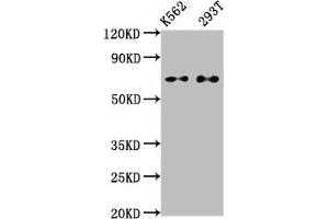 Western Blot Positive WB detected in: K562 whole cell lysate, 293T whole cell lysate All lanes: ATF2 antibody at 1. (Recombinant ATF2 抗体)