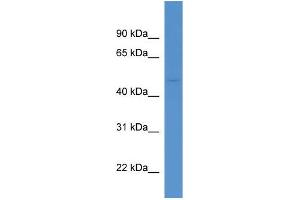 Mouse Kidney; WB Suggested Anti-Aadacl1 Antibody Titration: 0. (NCEH1 抗体  (Middle Region))