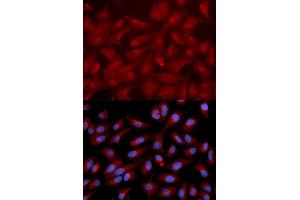 Immunofluorescence analysis of U2OS cells using RAPGEF3 antibody. (RAPGEF3 抗体)
