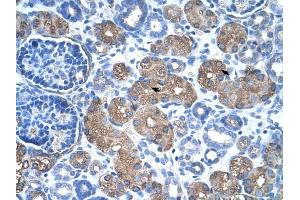 ASS1 antibody was used for immunohistochemistry at a concentration of 4-8 ug/ml to stain Epithelial cells of renal tubule (arrows) in Human Kidney. (ASS1 抗体  (C-Term))