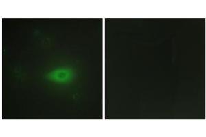 Immunofluorescence analysis of HepG2 ells, using HARS antibody. (HARS1/Jo-1 抗体  (C-Term))