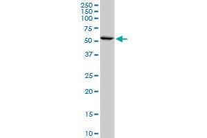 Western Blotting (WB) image for anti-CAP, Adenylate Cyclase-Associated Protein 1 (CAP1) (AA 1-475) antibody (ABIN523895)