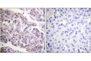 Immunohistochemistry (IHC) image for anti-Histone H4 (acLys12) antibody (ABIN2890734) (Histone H4 抗体  (acLys12))