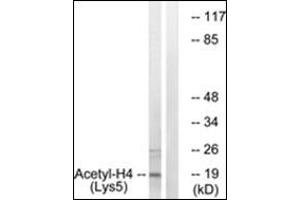 Western blot analysis of extracts from COS7 cells, treated with TSA 400nM 24h, using Histone H4 (Acetyl-Lys5) Antibody. (Histone H4 抗体  (acLys5))