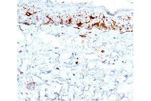 IHC testing of human skin stained with CD1a antibody (C1A/711). (CD1a 抗体)