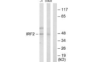 Immunohistochemistry analysis of paraffin-embedded human colon carcinoma tissue using IRF2 antibody. (IRF2 抗体  (Internal Region))