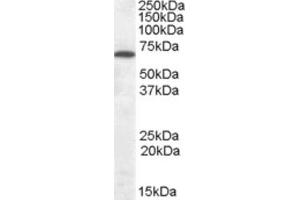 Western Blotting (WB) image for anti-Cannabinoid Receptor 1 (CNR1) (Internal Region) antibody (ABIN2465491) (CNR1 抗体  (Internal Region))