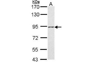 Western blot analysis of 30 ug of whole cell lysate (A: H1299) using a 7. (Progesterone Receptor 抗体)