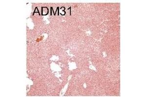 Blocking Antibody (Inhibition) image for anti-neonatal Fc Receptor (FcRn) antibody (ABIN1774762)