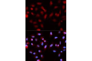 Immunofluorescence (IF) image for anti-Baculoviral IAP Repeat-Containing 5 (BIRC5) antibody (ABIN1875407) (Survivin 抗体)