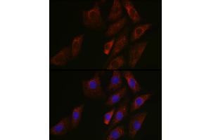 Immunofluorescence analysis of NIH/3T3 cells using SIRT3 Rabbit pAb (ABIN6134063, ABIN6147792, ABIN6147795 and ABIN6223143) at dilution of 1:50 (40x lens). (SIRT3 抗体  (C-Term))