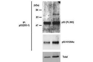 Western Blotting (WB) image for anti-Tumor Protein P53 (TP53) antibody (ABIN1449254) (p53 抗体)