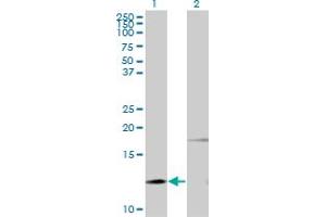 Western Blot analysis of PTH expression in transfected 293T cell line by PTH monoclonal antibody (M11), clone 3G9. (PTH 抗体  (AA 32-115))