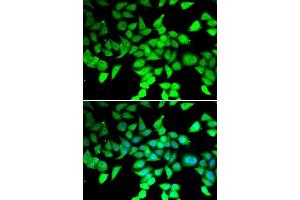 Immunofluorescence analysis of MCF-7 cells using HDAC7 antibody. (HDAC7 抗体  (AA 400-500))
