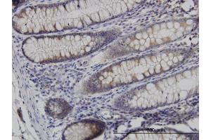 Immunostaining (ISt) image for anti-Necdin Homolog (Mouse) (NDN) (AA 222-321) antibody (ABIN518218)