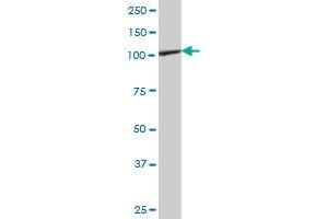 PTK2B MaxPab polyclonal antibody. (PTK2B 抗体  (AA 1-1009))