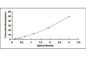 ELISA image for IgA Secretory Component ELISA Kit (ABIN481718) (IgA Secretory Component ELISA 试剂盒)