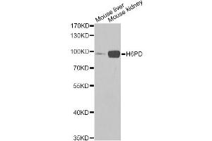 Western blot analysis of extracts of various cell lines, using H6PD Antibody (ABIN5973840) at 1/1000 dilution. (Glucose-6-Phosphate Dehydrogenase 抗体)