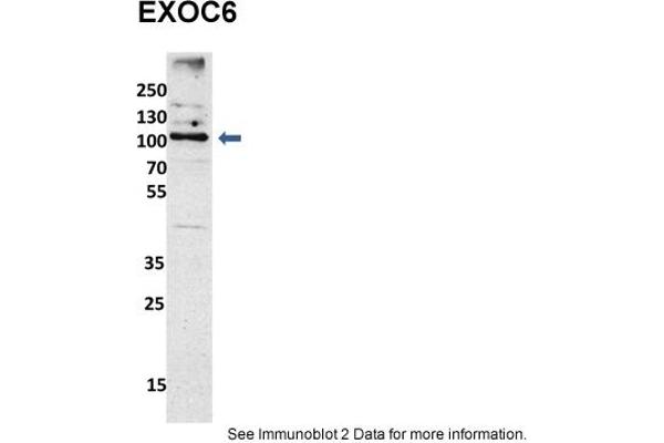 EXOC6 抗体  (N-Term)