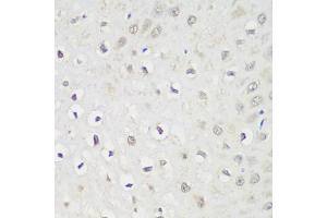 Immunohistochemistry of paraffin-embedded human esophagus using KPNA3 antibody. (KPNA3 抗体)