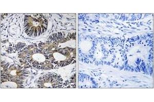 Immunohistochemistry (IHC) image for anti-Eukaryotic Translation Initiation Factor 1A, Y-Linked (EIF1AY) (AA 21-70) antibody (ABIN2890311) (EIF1AY 抗体  (AA 21-70))