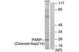 Western blot analysis of extracts from A549 cells, treated with etoposide 25uM 24h, using PARP (Cleaved-Asp214) Antibody. (PARP1 抗体  (Cleaved-Asp214))