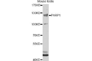 Western blot analysis of extracts of mouse testis, using PARP1 antibody (ABIN5995673) at 1/1000 dilution. (PARP1 抗体)