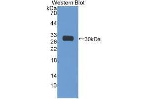 Detection of Recombinant Ki67P, Human using Monoclonal Antibody to Ki-67 Protein (Ki-67) (Ki-67 抗体  (AA 3088-3235))