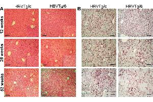 Paraffin-embedded sections of transgenic mice liver were stained with an antibody against HBsAg (ABIN285516). (HBSAg 抗体)