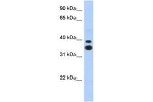 Image no. 1 for anti-Msh Momeobox 2 (Msx2) (N-Term) antibody (ABIN6742203) (Msx2/Hox8 抗体  (N-Term))