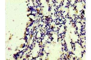 IHC image of ABIN7127275 diluted at 1:100 and staining in paraffin-embedded human lung tissue performed on a Leica BondTM system. (Recombinant CD163 抗体)