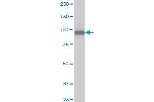 SRPK1 monoclonal antibody (M03), clone 6G9 Western Blot analysis of SRPK1 expression in Jurkat . (SRPK1 抗体  (AA 371-470))