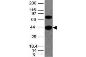 Western blot of human SKM tissue lysate using pan Muscle Actin antibody (Pan Muscle Actin 抗体)