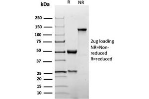 SDS-PAGE Analysis Purified p27 Recombinant Rabbit Monoclonal Antibody (KIP1/1355R). (Recombinant CDKN1B 抗体)