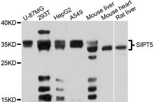 Western blot analysis of extracts of various cell lines, using SIRT5 antibody. (SIRT5 抗体)