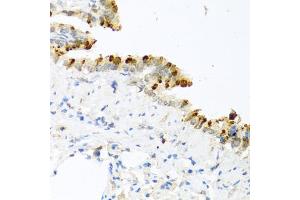 Immunohistochemistry of paraffin-embedded mouse lung using BMP4 antibody (ABIN5997308) at dilution of 1/100 (40x lens). (BMP4 抗体)