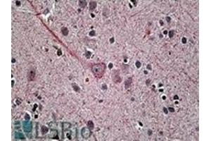 Image no. 2 for anti-Synaptotagmin I (SYT1) (Internal Region) antibody (ABIN375123) (SYT1 抗体  (Internal Region))