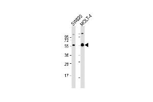 All lanes : Anti-RUNX1 Antibody  at 1:2000 dilution Lane 1: S whole cell lysate Lane 2: MOLT-4 whole cell lysate Lysates/proteins at 20 μg per lane. (RUNX1 抗体  (AA 227-255))