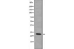 Western blot analysis of extracts from COLO cells, using MRPL20 antibody. (MRPL20 抗体  (C-Term))