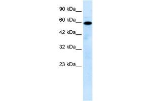 WB Suggested Anti-MCOLN1 Antibody Titration:  0. (MCOLN1 抗体  (N-Term))