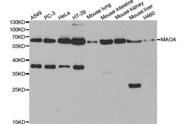 Monoamine Oxidase A 抗体  (AA 1-260)