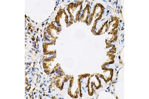 Immunohistochemistry of paraffin-embedded rat lung using HSP90AB1 Antibody (ABIN5970445) at dilution of 1/100 (40x lens). (HSP90AB1 抗体)
