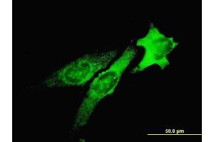 Immunofluorescence (IF) image for anti-Tumor Susceptibility Gene 101 (TSG101) (AA 201-280) antibody (ABIN563269)