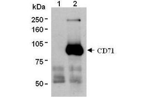 Western Blotting (WB) image for anti-Transferrin Receptor (p90, CD71) (TFRC) antibody (ABIN1449271) (Transferrin Receptor 抗体)