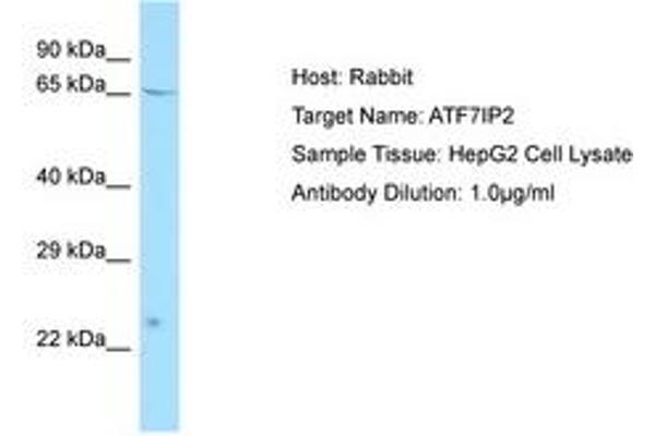 ATF7IP2 抗体  (AA 100-149)