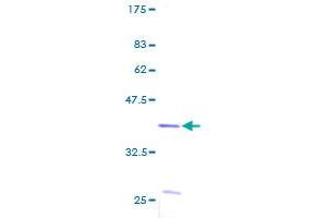 Image no. 1 for S100 Calcium Binding Protein A2 (S100A2) (AA 1-97) protein (GST tag) (ABIN1319057) (S100A2 Protein (AA 1-97) (GST tag))