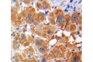 IHC-P analysis of Liver tissue, with DAB staining. (Apolipoprotein F 抗体  (AA 111-314))