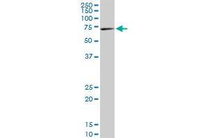 RPS6KB1 monoclonal antibody (M03), clone 2C2. (RPS6KB1 抗体  (AA 416-525))