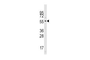 Western blot analysis of Cdc25A Pab (ABIN390213 and ABIN2840695) in mouse kidney tissue lysates (35 μg/lane). (CDC25A 抗体  (N-Term))