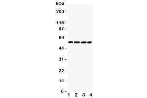 Western blot testing of IRF5 antibody and Lane 1:  human placenta (IRF5 抗体  (C-Term))